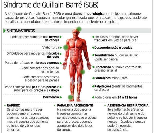 Sintomas da Síndrome de Guillain Barré