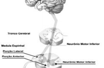 Neurônio Motor Superior e Neurônio Motor Inferior